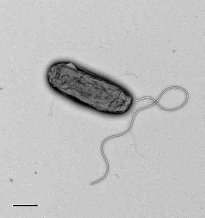 혐기성 Ketobacter 속 GI5T의 전자현미경 사진