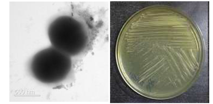 멸종위기 동물 안데스콘도르 장내 Brachybacterium 속 신발굴종 VR2412의 전자현미경과 배양체 사진