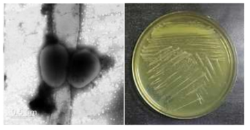 멸종위기 동물 안데스콘도르 장내 Brachybacterium 속 신발굴종 VR2415의 전자현미경과 배양체 사진