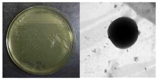 멸종위기 동물 안데스콘도르 장내 Rhodococcus 속 신발굴종 VT2414의 배양체 사진과 전자현미경 사진