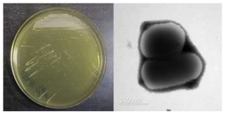 멸종위기 동물 안데스콘도르 장내 Brevibacterium 속 신발굴종 VT2418의 배양체 사진과 전자현미경 사진