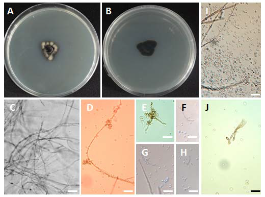 금골산의 소나무 근권 토양시료로부터 분리된 국내 미기록종인 Exophiala bergeri CNUFC-PTM407 균주의 콜로니 및 균체 모습