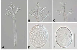 경기도 남양주에서 채집한 나도재쑥 (Descurainia pinnata)에 노균병을 일으키는 국내 미기록종 Hyaloperonospora sisymbrii-sophiae KUS-F29737 균주의 포자경 및 포자 모습