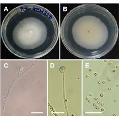 제주도 금산공원에서 채집한 토양시료에서 분리된 국내 미기록종 Umbelopsis changbaiensis EML-GEU228-1 균주의 콜로니 및 균체 모습