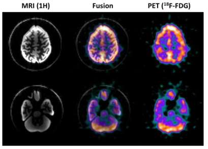 3차원 뇌팬텀에 대한 PET/MR 동시 영상 1H MRI 영상, PET/MR 정합 영상, 18F-FDG PET 영상