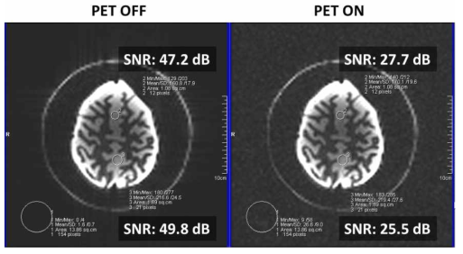 PET의 전원을 끈 경우와 PET/MR 동시 영상화할 때의 뇌 팬텀 MRI 영상