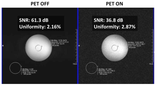 PET의 전원을 끈 경우와 PET/MR 동시 영상화할 때의 균일도 팬텀 MRI 영상