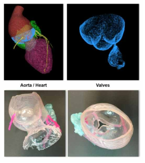 대동맥근위부 판막성형술을 위한 심장 CT의 분할결과 (위)와 이를 이용한 3D-프린팅의 예시