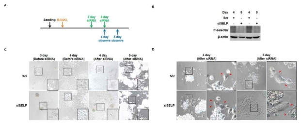 Selp의 발현 조절에 따른 파골세포 형태 변화