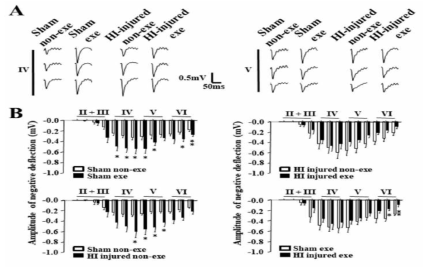 (A) ipsileiosnal forepaw 자극에 대한 S1 sensory cortex 영역에서의 LFP response (B) ipsilesional forepaw 자극에 대한 LFP negative defletion amplitudes