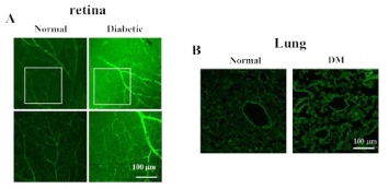 정상 및 당뇨마우스의 retina 와 폐조직 내 TG2 활성도