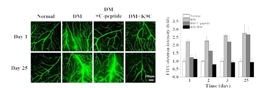 H9C의 당뇨병성 망막증 억제효과 확인