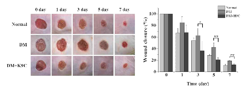 H9C의 당뇨병성 상처치유 지연 억제효과 확인