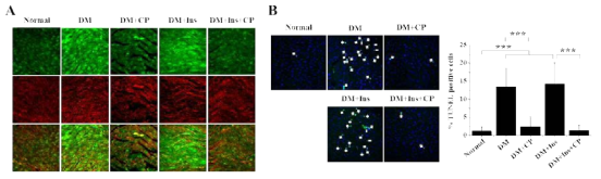 당뇨병성 심혈관 질환에서 C-peptide 와 insulin의 동시치료 효과 확인