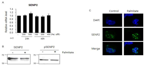 NIT-1 세포에서 palmitate에 의한 SENP2의 발현 및 활성 평가