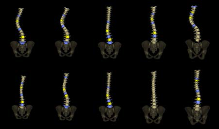 Reconstructed 3D geometry model of spine