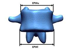 Dimensions of lumbar in coronal plane