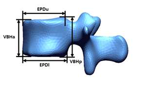 Dimensions of lumbar in sagittal plane