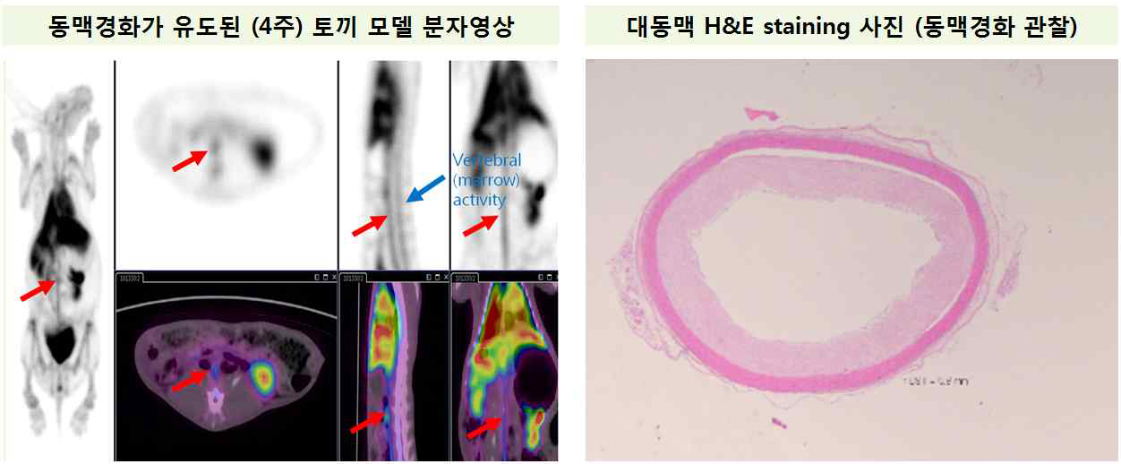 Phosphate backbone에 Zr 동위원소 표지 방법 비교 결과