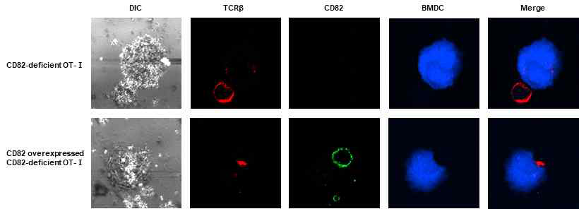 CD82 발현 복원에 따른 면역 시냅스 내 T 세포 수용체의 축적 변화 측정