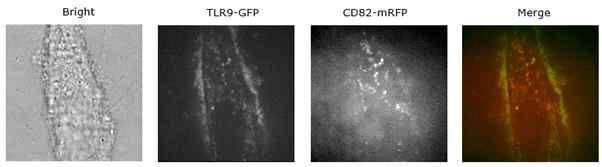 TLR9과 CD82의 수지상세포 내 분포 분석