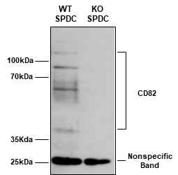 CD82 단백질 발현 비교