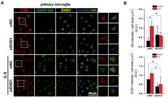 EHD1 knock-down은 IL-6에 의한 cholesterol-enriched membrane rafts의 형성을 방해함