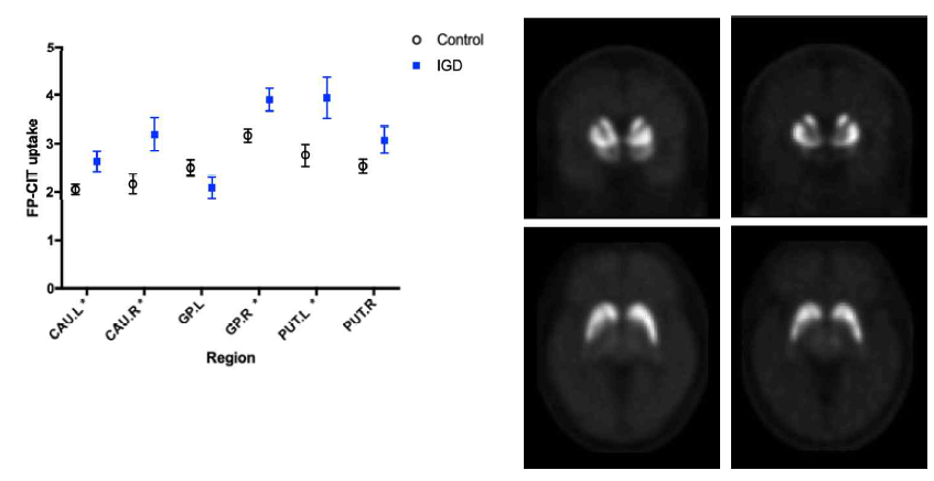 Basal ganglia 내의 subregions에서의 DAT mean density (그래프). (left) 정상군, (right) 중독군 (그림)