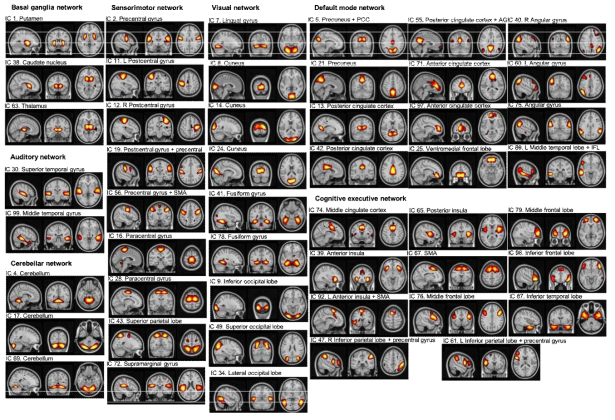 인터넷 중독군과 정상군의 dynamic functional connectivity (7 networks; auditory network, visual network, sensorimotor network, default-mode network, cognitive executive network, basal ganglia network, cerebellar network)