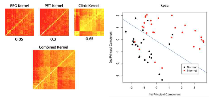 (좌) 각단일 모달리티의 feature에 따른 그룹 분류와 다중 모 달리티에 따른 통 합 커널의 분류. (우) combined kernel을 사용하여 PCA 결과