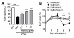 Antiviral activity of manassantin B against coxsackievirus B3 in vitro and in vivo