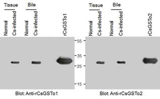 Immunoblot analysis of proteins extracted from C. sinensis infected biliary ductal cells and bile juice