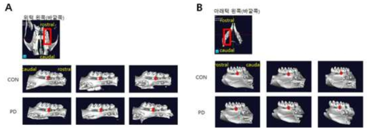 uCT image of mouse tooth and jaw from mouse model of periodontal disease