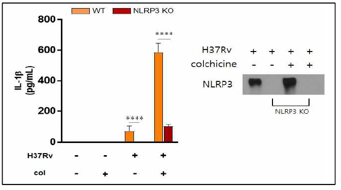 결핵균이 감염된 큰포식세포 내 NLRP3 inflammasome 과 colchicine 간의 관계 분석