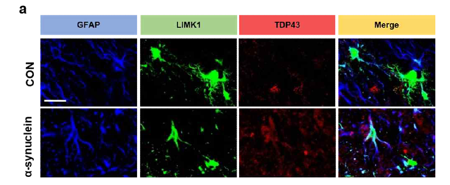 α-synuclein를 이용한 PD 동물 모델 흑질에서의 LIMK1 발현 세포 규명