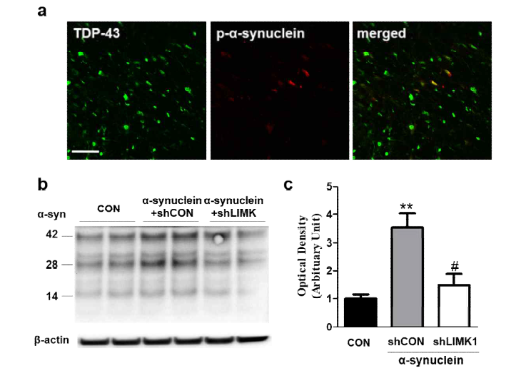 siLIMK1의 α-synuclein과 TDP-43 침작 저해를 통한 도파민 신경세포 보호 기전 확인