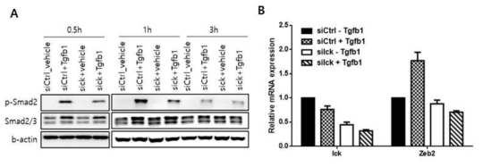 Ick 발현 감소에 따른 Tgfb-1 induced Smad2 signliang 변화 검증. (A) Ick 발현 감소에 따른 p-Smad2 단백질 발현 변화 확인 (B) Ick 발현 감소에 따른 Smad2 signaling의 target 유전자 발현 변화 확인