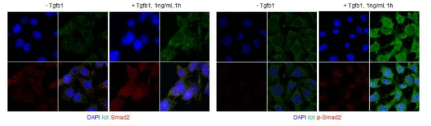 Tgfb-1 처리에 따른 Ick 단백질의 세포 내 발편 및 localization 변화 관찰. 정상 마우스 신장 상피세포에 Tgfb-1 처리 전/후 상황에서 Ick, Smad2, p-Smad2 localization 확인