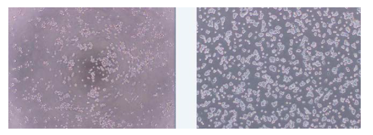 인체단핵세포주(THP-1)배양에 배양촉진성분 0.1 ug/mL을 첨가 한 후의 3일 후 비교 분석 결과로서 왼쪽 사진은 배양촉진성분이 첨가되지 않은 상태이며, 오른쪽 사진은 배양촉진성분이 첨가된 상태임. Control에 대비 cell 수가 2 배이상 관찰된 결과로 독성도 없으며 동일한 cell 배양 기간으로 보면 cell 증가 촉진 효능도 있는 것으로 판단됨