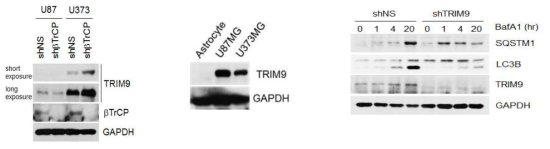 교모세포종에서 betaTrCP 신규 표적단백질 TRIM9의 기능연구