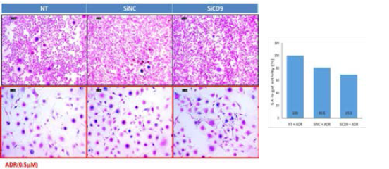 CD9 억제시 adriamycin (ADR) 처리로 유도되는 B16F10 세포의 노화 확인