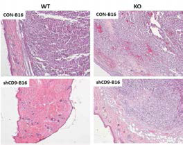 CD9 WT/KO 마우스를 이용한 xenograft 모델에서 shCD9 흑색종 세포의 암의 성장에 따른 조직병리학적 변화