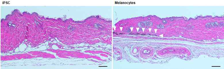 유도만능 줄기세포와 분화시킨 멜라닌 세포시트를 이식한 피부 절편의 조직학적 특성. (左) 유도만능 줄기세포시트, (右) 멜라닌 세포시트 이식군. 화살표는 멜라닌 세포임. (scale bar = 50 μm)