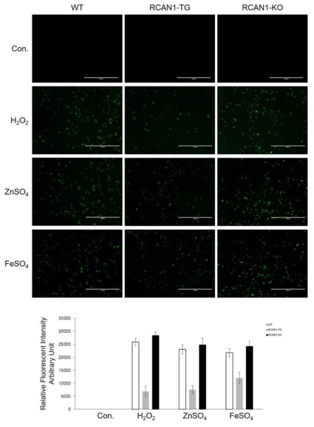 RCAN1 발현량에 따른 primary lung fibroblast의 세포내 ROS level 차이