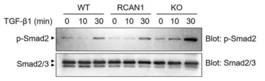 Primary lung fibroblast에서 RCAN1의 발현량에 따른 Smad2의 인산화 변화