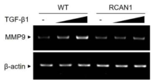 Primary lung fibroblast에서 RCAN1의 발현량에 따른 MMP9의 mRNA 발현량 변화