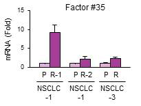 factor #35의 여러 항암제 내성 세포에서의 발현 변화