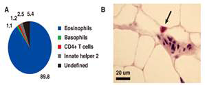 Infiltration of eosinophils in the adipose tissue