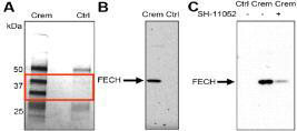 FECH is a target of cremastranone. (A) Cremastranone analog photoaffinity reagent (Crem) and control compound (Ctrl) were used in a pulldown experiment to identify two unique protein bands (in red box) from a porcine brain lysate on silver-stained gel. (B) One band was identified as FECH, confirmed by immunoblot. (C) Cellular FECH could be competed off the affinity reagent with an excess (100 μM) of free cremastranone isomer SH-11052