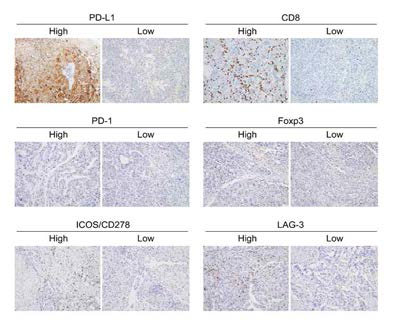 Representative photomicrographs showing immunoreactivities for PD-L1, CD8, PD-1, Foxp3,ICOS, and LAG-3